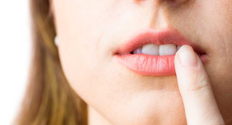 Més informació sobre l'article Per què surten aftes o úlceres bucals?