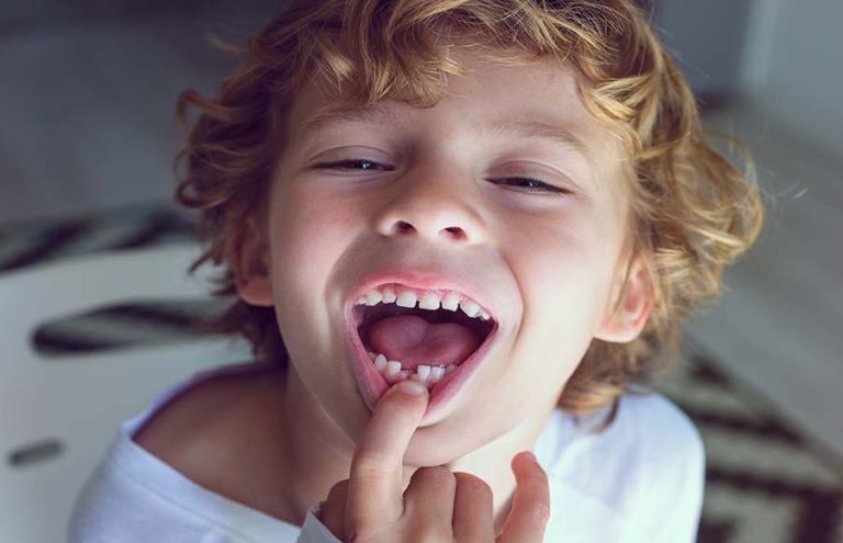 Lee más sobre el artículo ¿A qué edad empiezan a caerse los dientes de leche?