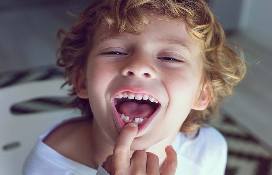 En este momento estás viendo ¿A qué edad empiezan a caerse los dientes de leche?