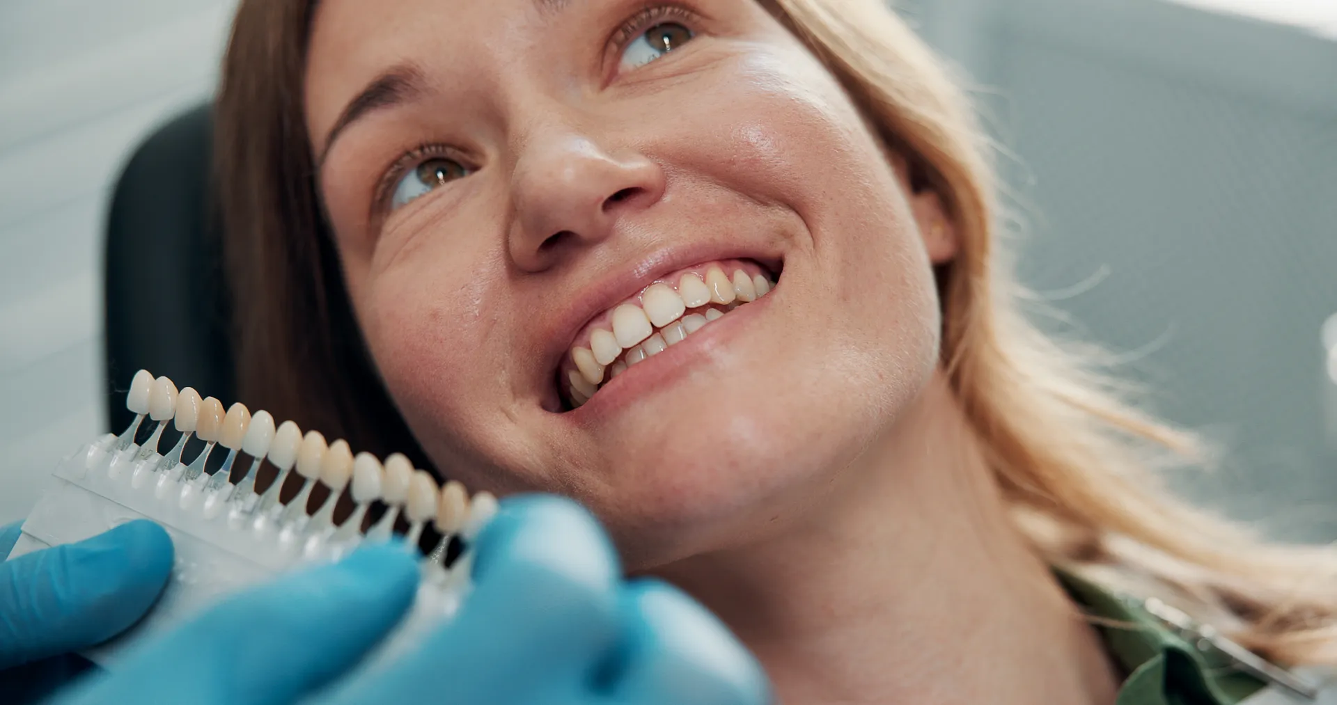 Actualment esteu veient Facetes dentals sense tallament: valen la pena?