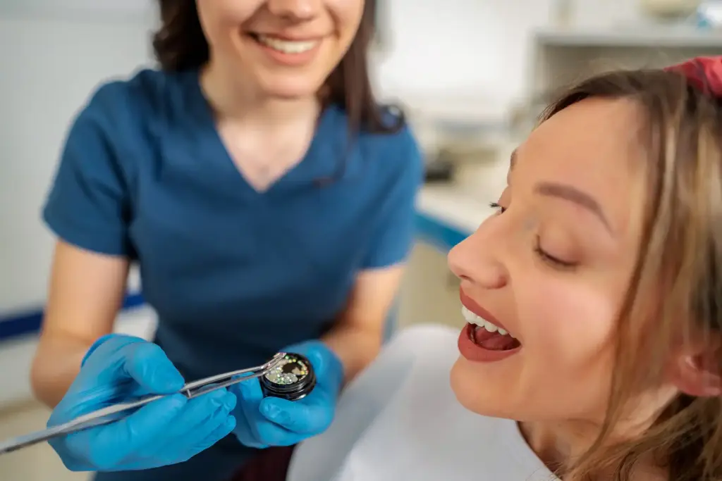 Més informació sobre l'article Què pensen els dentistes de les gemmes dentals?
